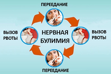 Лечение булимии в Богучанах